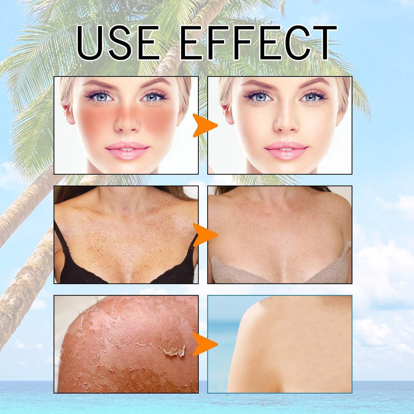 Breathable And Powerful Sunscreen Gel