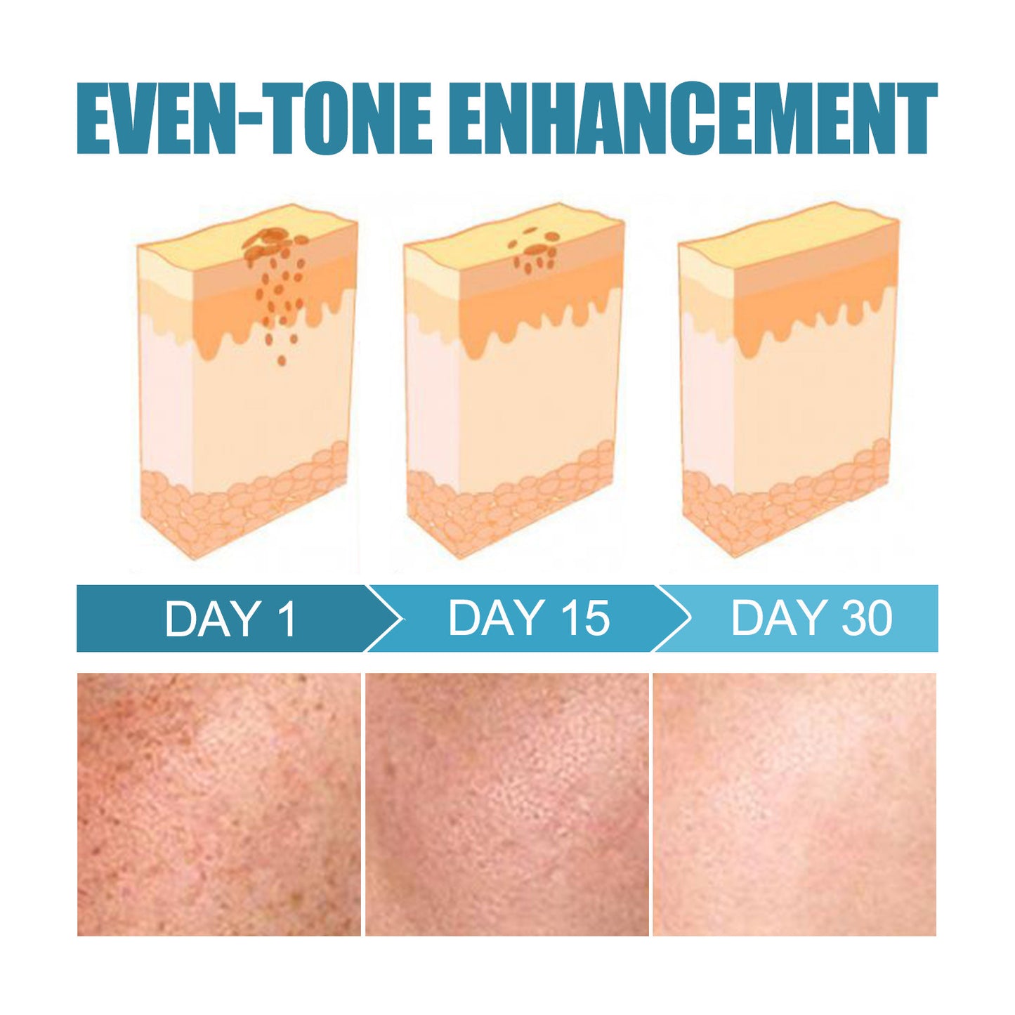 West&Month Skin Care Bar Armpit Joint Elbow Dark Skin Moisturizing Care Hydrating Moisturizing