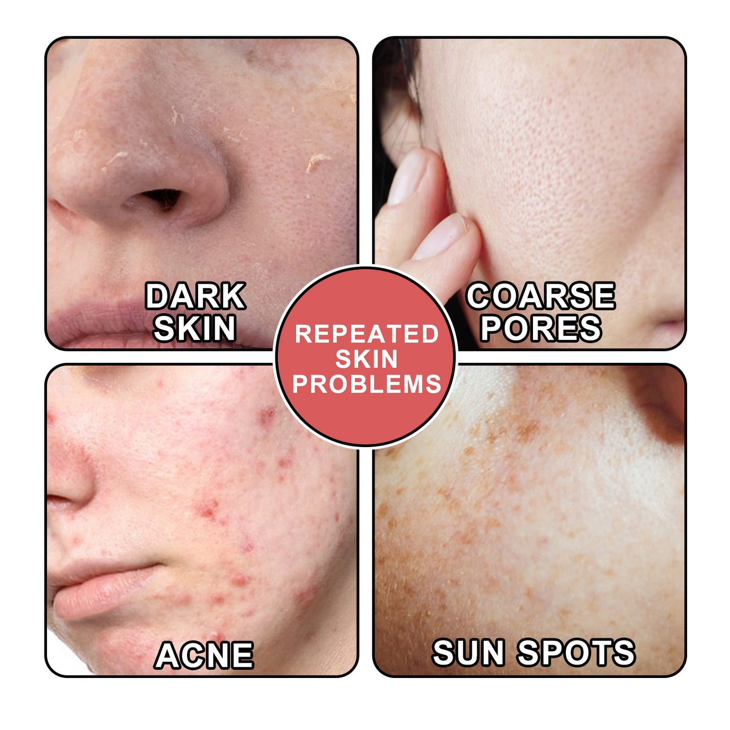 South Moon Nicotinamide Skin Care Essence Facial Skin Hydrating And Firming Skin Care Essence