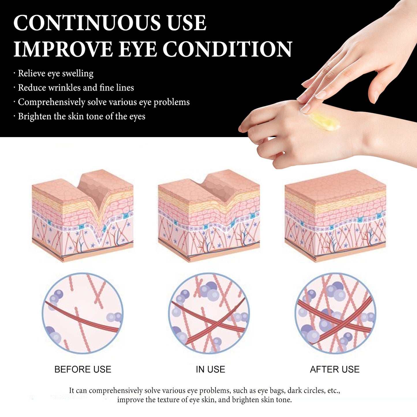 Wiyun Eye Cream: Gentle And Nourishing Care For The Skin Around The Eyes, Soft And Tender Skin Care, Hydrating Skin Care Eye Cream